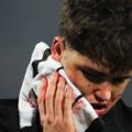 Warrior. Barcelona defender Cubarsi received 10 stitches in his face. What happened? 