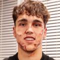 Cubarsi, avec 10 points de suture au visage, veut jouer le prochain match