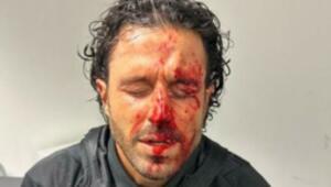 Lyon coach spoke for the first time about the attack by Marseille fans